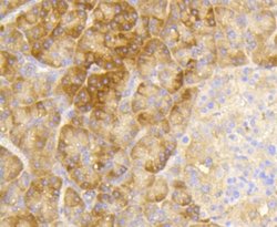 eIF2A, p Ser51 Antibody (SZ01-06), Novus Biologicals 100&mu;L:Antibodies,